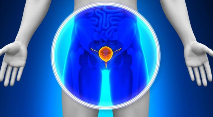 Tumore della Prostata, meno biopsie inutili con la Fusion Imaging tagmedicina,prostata