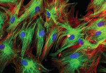 Osteoimmunologia: la nuova frontiera dell’osteoporosi #tagmedicina, osteoimmunologia