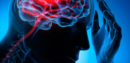 Il colesterolo LDL-troppo basso indica un rischio aumentato di emorragia intracerebrale #tagmedicina,colesterolo