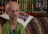 Malattie Rare: Progeria o Sindrome di Hutchinson-Gilford tagmedicina,progeria