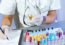 Cancro vescica: nuovo test molto sensibile permette di rilevarlo in maniera non invasiva tagmedicina,Cancro