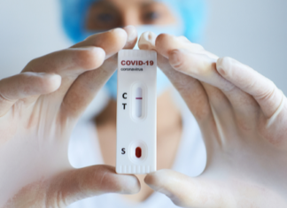 Covid-19, test rapido non è così accurato come si pensava. Uno studio spiega perché tagmedicina,test
