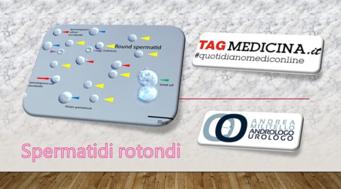 Speranza di successo di gravidanza nella azoospermia secretiva. L’uso degli spermatidi rotondi può aiutare? tagmedicina, azoospermia