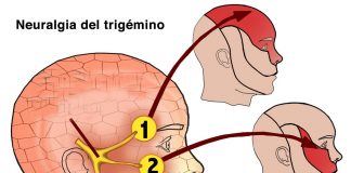 tagmedicina,Trigemino