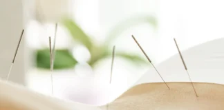 L’arte del punto: viaggio nelle differenze tra agopuntura classica, tradizionale, riflessoterapia e neuroagopuntura