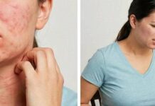 Realtà e bufale sulle allergie e intolleranze alimentari: guida per orientarsi tra scienza e falsi miti