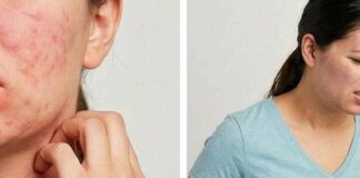Realtà e bufale sulle allergie e intolleranze alimentari: guida per orientarsi tra scienza e falsi miti