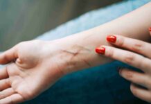 Suicidio e autolesionismo negli adolescenti, i segnali da non sottovalutare